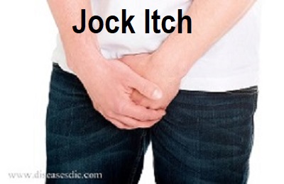 How to get rid of stubborn jock itch - Quora