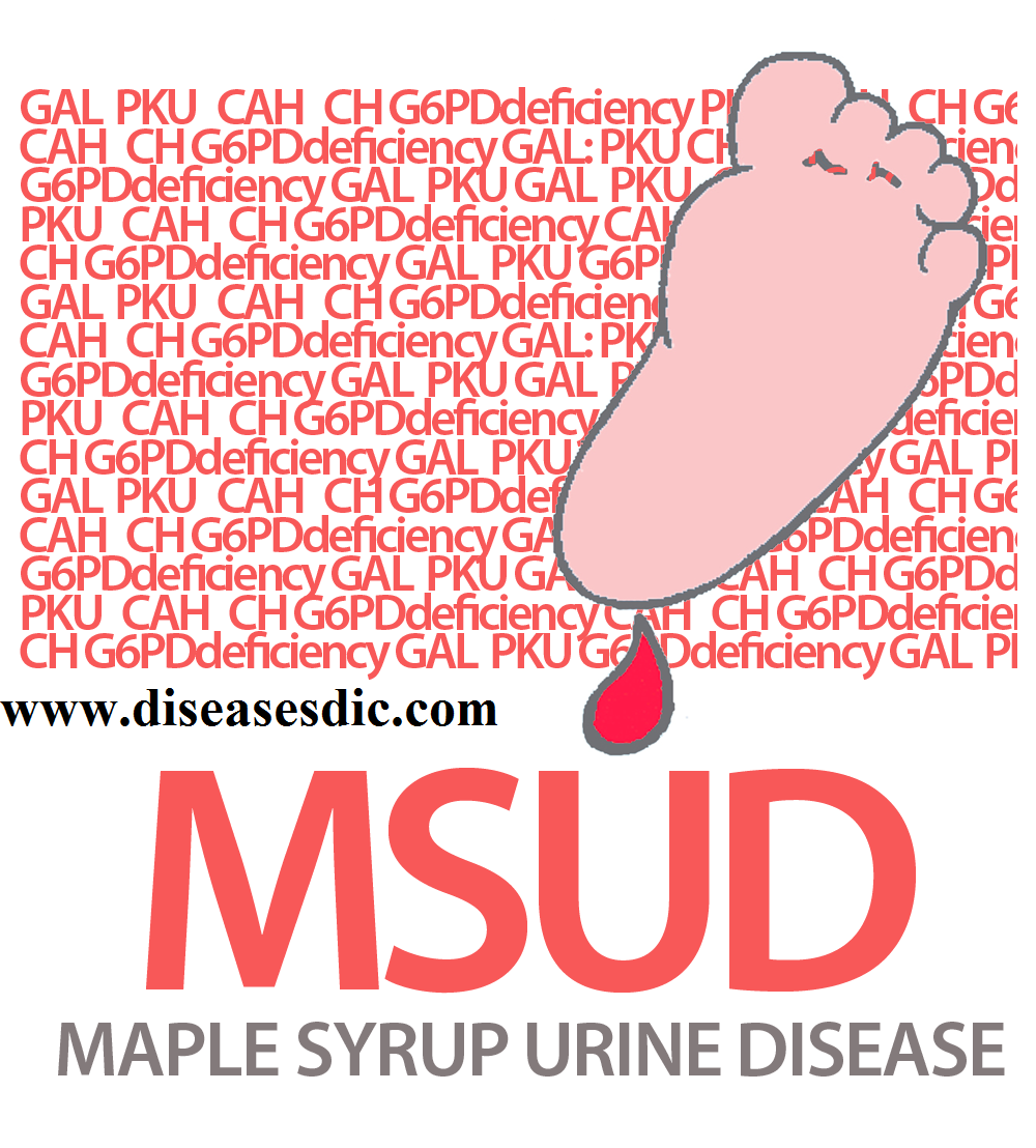 maple syrup urine disease icd 10