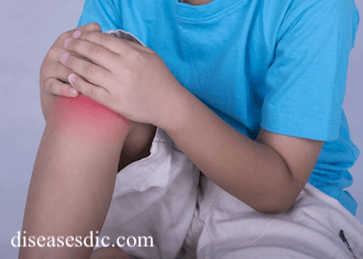Juvenile idiopathic arthritis jia