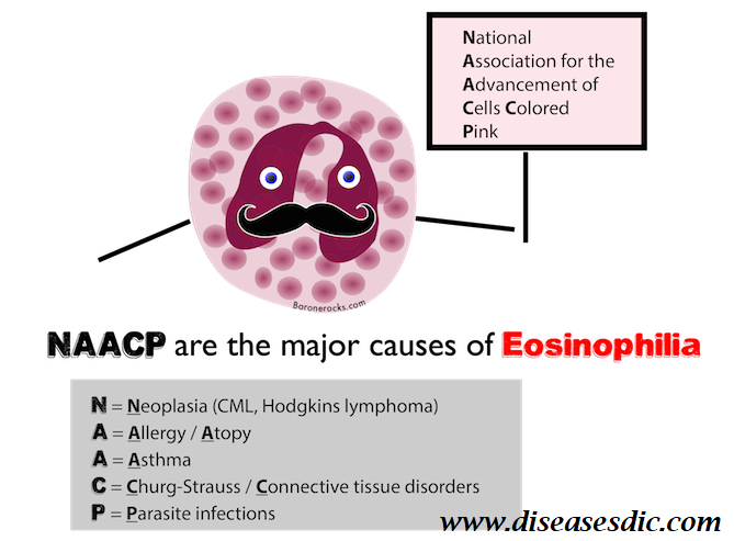 High Eosinophils Causes And Symptoms 7743