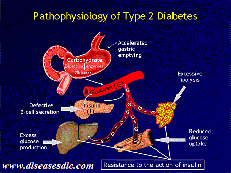type 2 diabetes mellitus