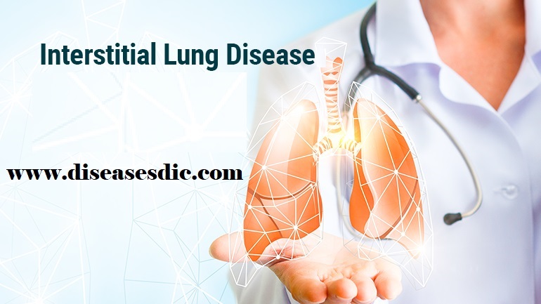 interstitial-lung-disease-complications-and-treatment