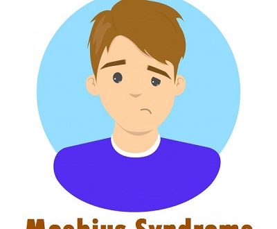 Moebius Syndrome – Causes, Types, Diagnosis and Treatment