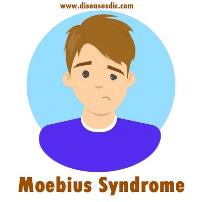 What Is Moebius Syndrome Moebius Syndrome Foundation - vrogue.co