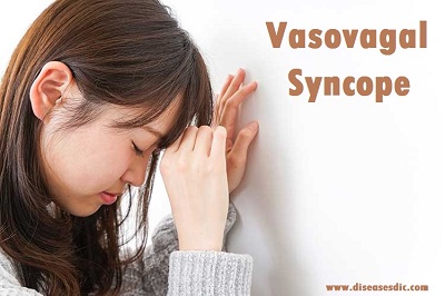 Vasovagal syncope or Neurocardiogenic syncope – Overview
