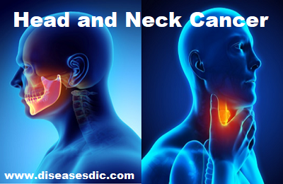 Head and Neck Cancer – Types, Risk Factors, and Prevention.